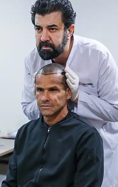 best hair transplant clinics in Turkey